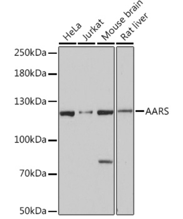 AARS Rabbit Polyclonal Antibody
