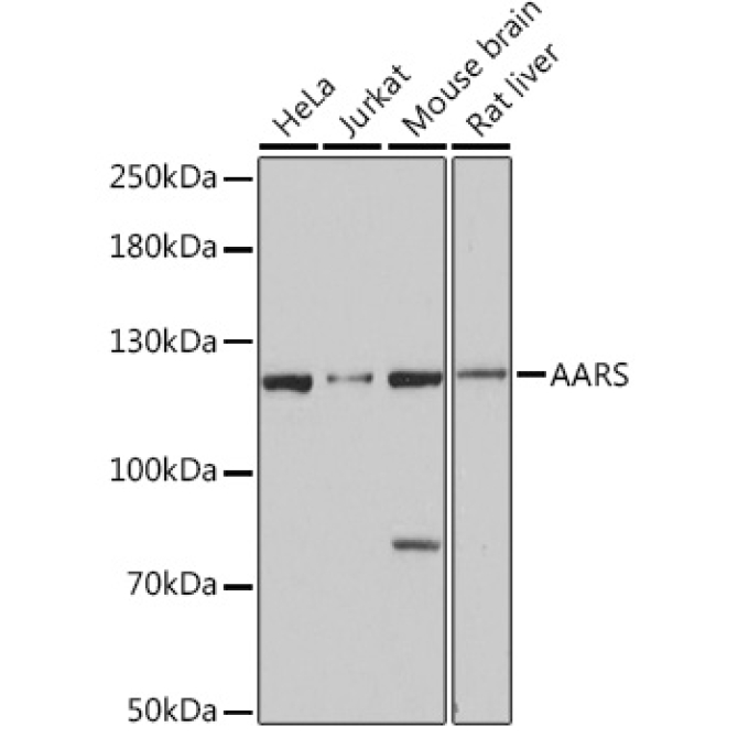 AARS Rabbit Polyclonal Antibody