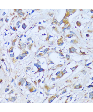 ACADSB Rabbit Polyclonal Antibody
