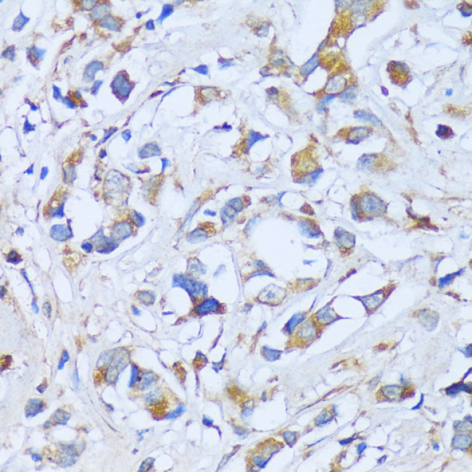 ACADSB Rabbit Polyclonal Antibody