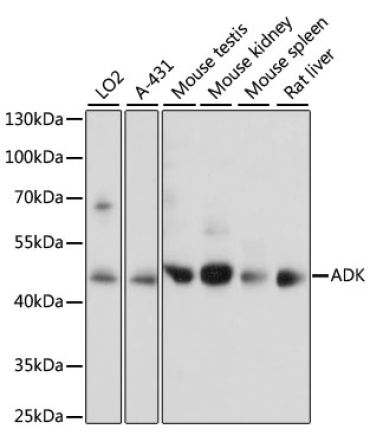 ADK Rabbit Polyclonal Antibody