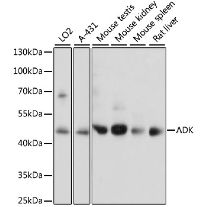 ADK Rabbit Polyclonal Antibody