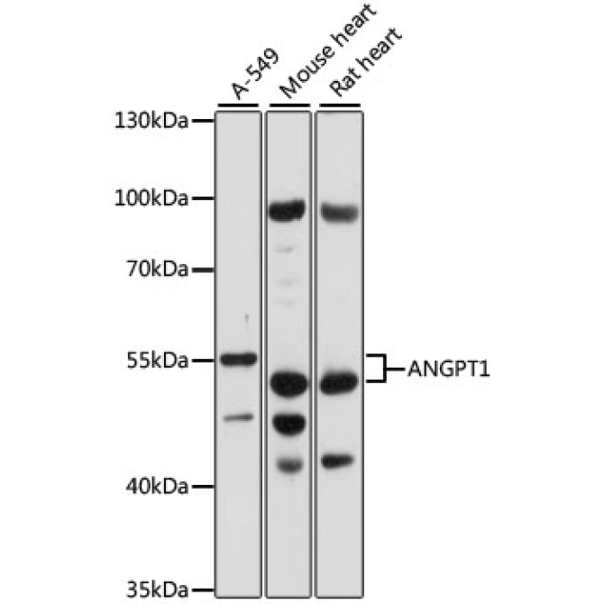 ANGPT1 Rabbit Polyclonal Antibody