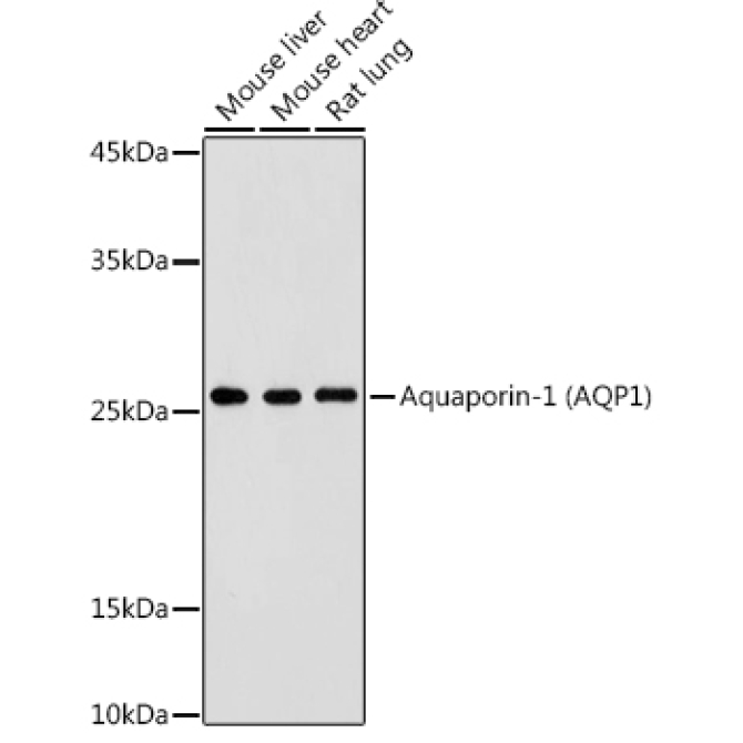 Aquaporin-1 (AQP1) Rabbit Polyclonal Antibody