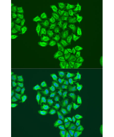 BNIP3 Rabbit Polyclonal Antibody