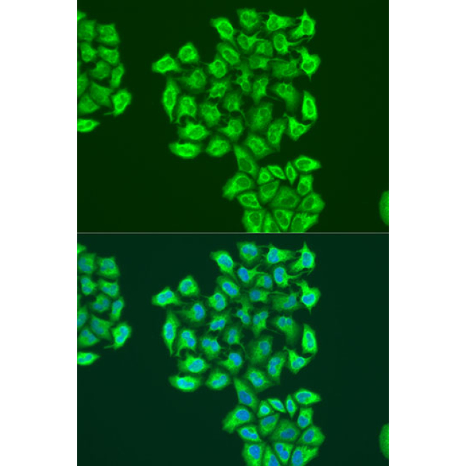 BNIP3 Rabbit Polyclonal Antibody