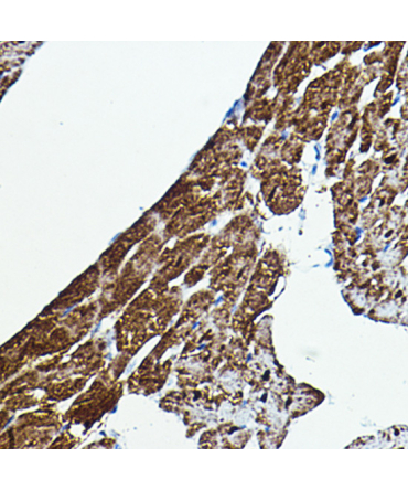 B-Raf Rabbit Polyclonal Antibody