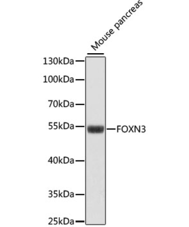 FOXN3 Rabbit Polyclonal Antibody