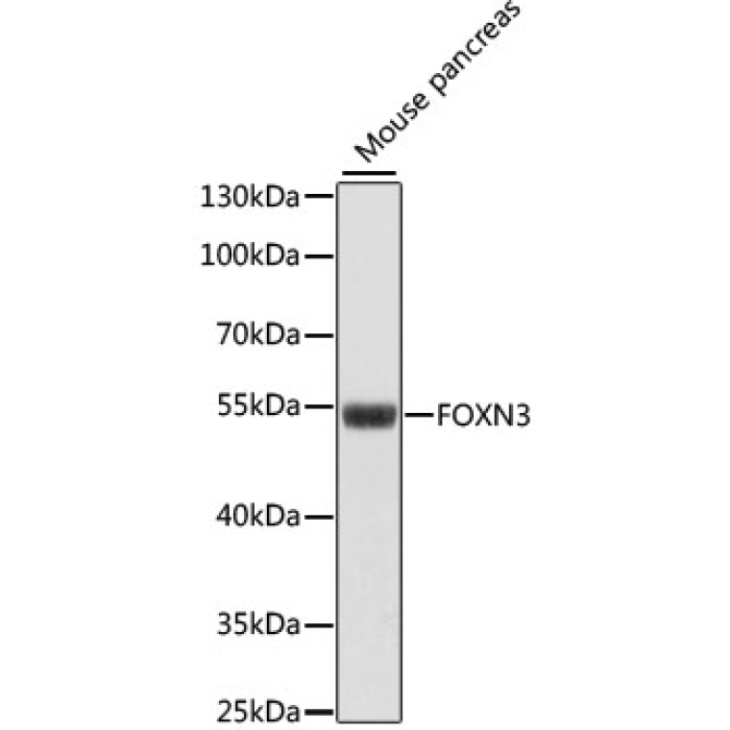 FOXN3 Rabbit Polyclonal Antibody