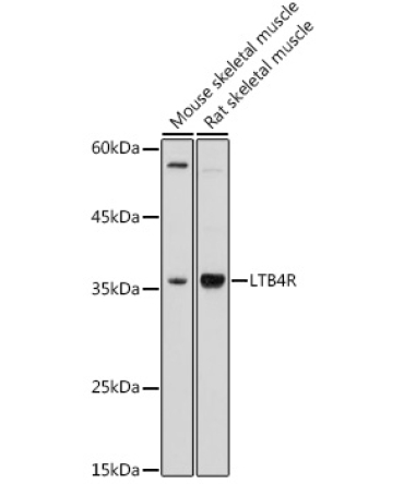 LTB4R Rabbit Polyclonal Antibody