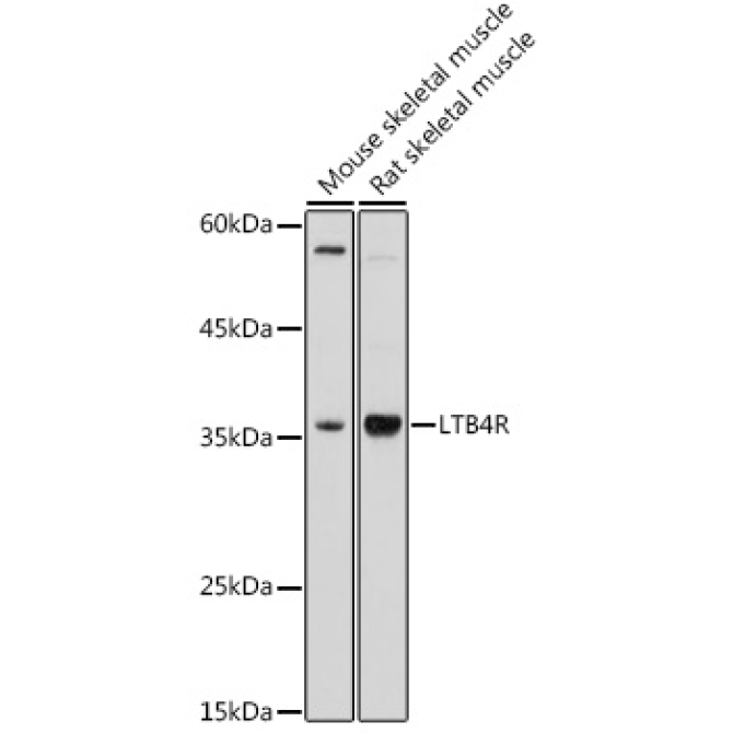 LTB4R Rabbit Polyclonal Antibody
