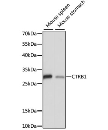 CTRB1 Rabbit Polyclonal Antibody