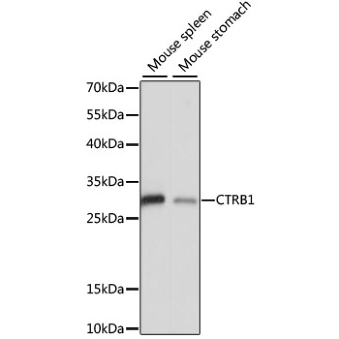 CTRB1 Rabbit Polyclonal Antibody