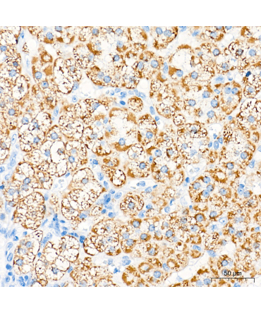 CYP11B1 Rabbit Polyclonal Antibody