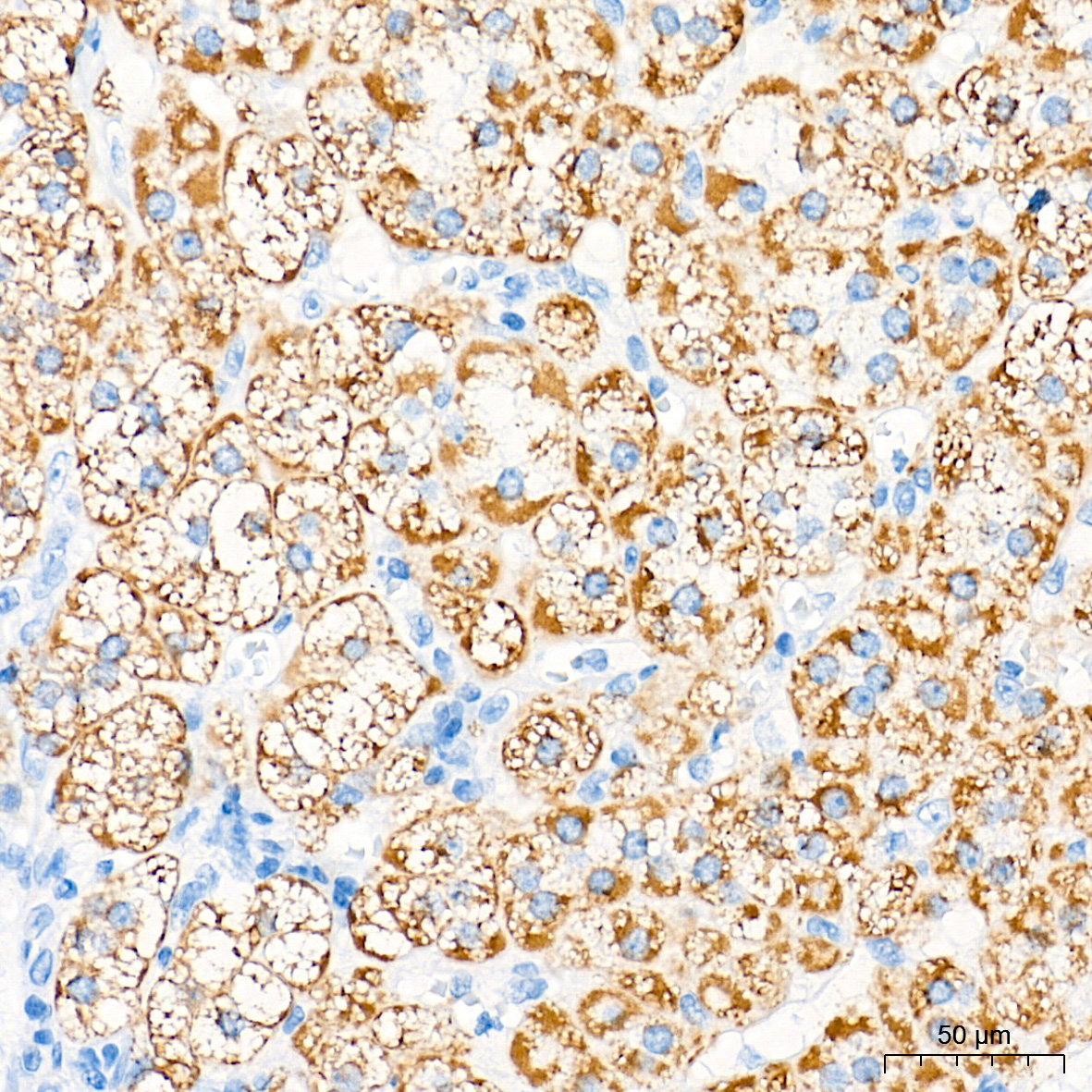 CYP11B1 Rabbit Polyclonal Antibody