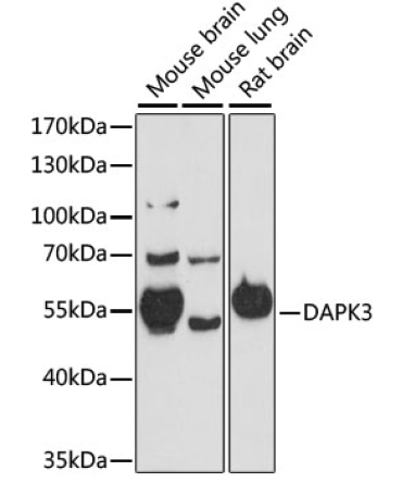 DAPK3 Rabbit Polyclonal Antibody