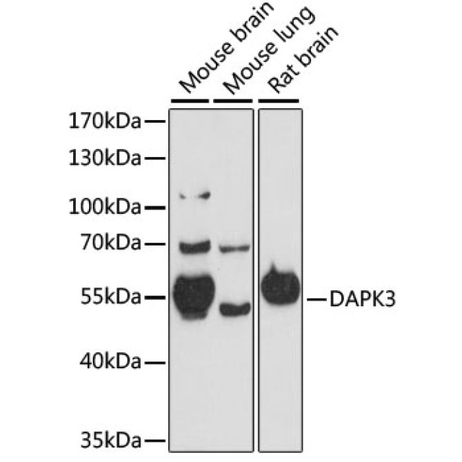 DAPK3 Rabbit Polyclonal Antibody