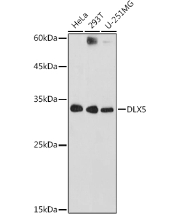DLX5 Rabbit Polyclonal Antibody