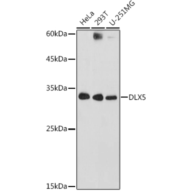 DLX5 Rabbit Polyclonal Antibody