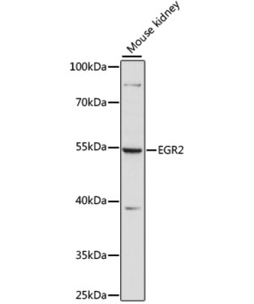 EGR2 Rabbit Polyclonal Antibody