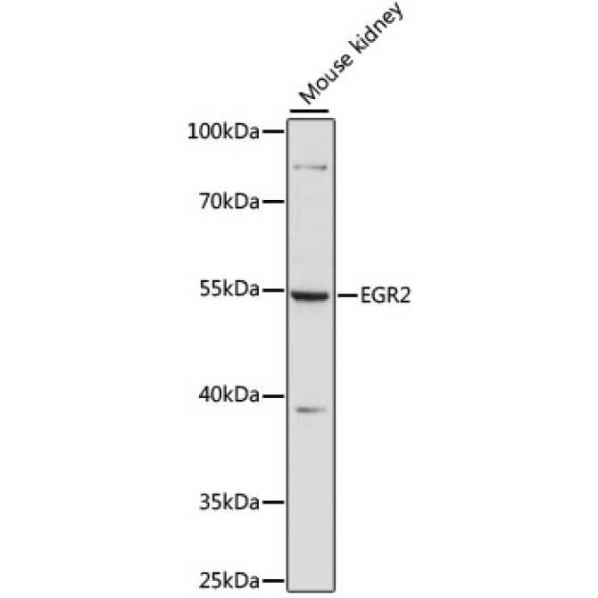 EGR2 Rabbit Polyclonal Antibody