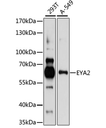EYA2 Rabbit Polyclonal Antibody