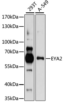 EYA2 Rabbit Polyclonal Antibody