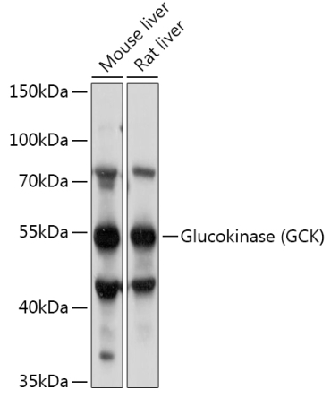 Glucokinase (GCK) Rabbit Polyclonal Antibody