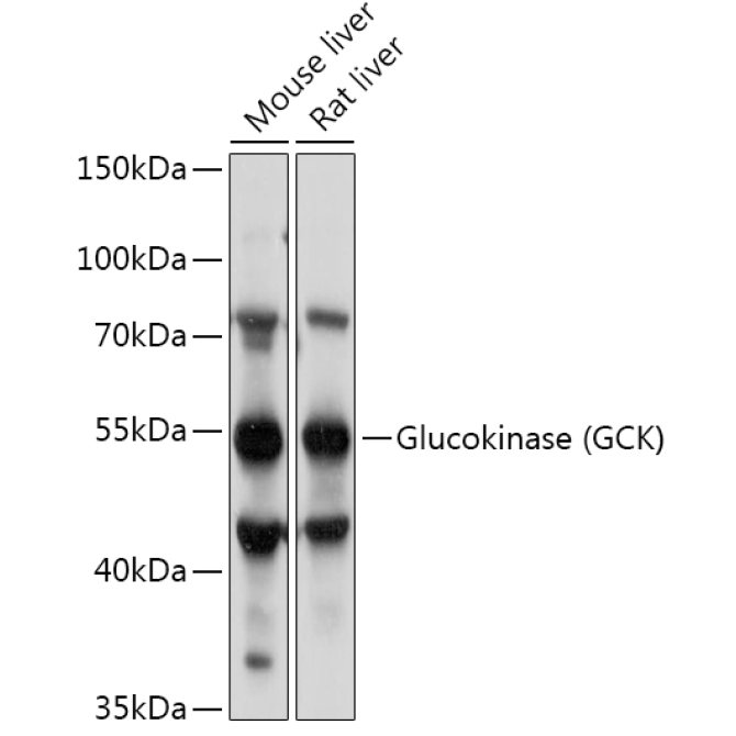Glucokinase (GCK) Rabbit Polyclonal Antibody