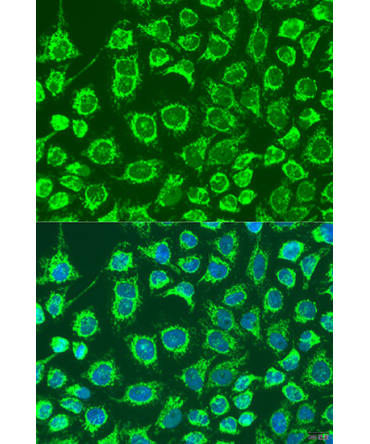 GYPB Rabbit Polyclonal Antibody