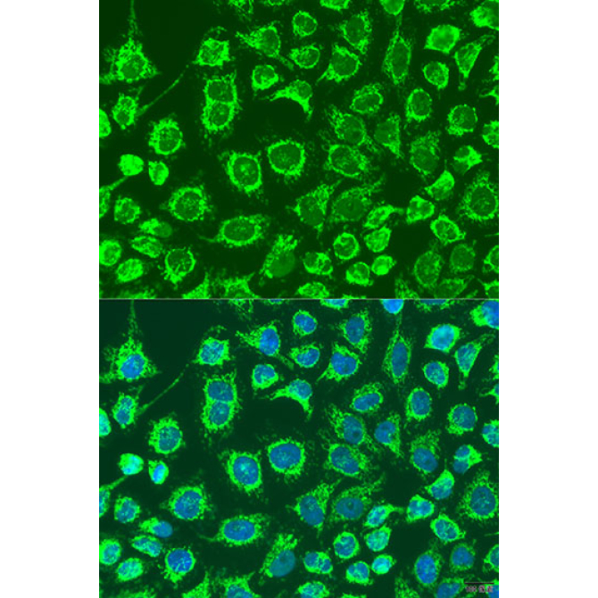 GYPB Rabbit Polyclonal Antibody
