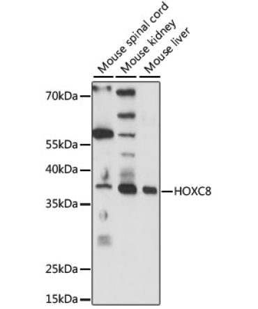 HOXC8 Rabbit Polyclonal Antibody