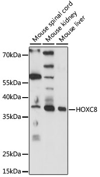 HOXC8 Rabbit Polyclonal Antibody