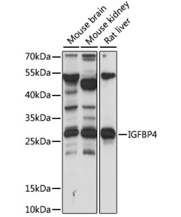 IGFBP4 Rabbit Polyclonal Antibody