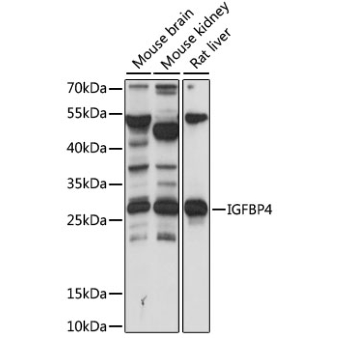 IGFBP4 Rabbit Polyclonal Antibody