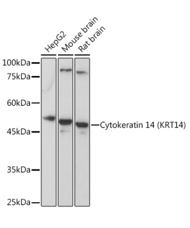Cytokeratin 14 (KRT14) Rabbit Polyclonal Antibody