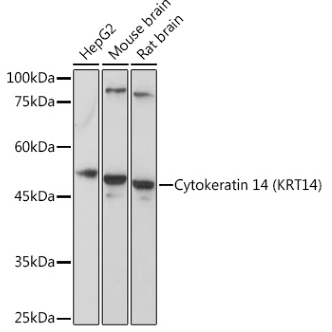 Cytokeratin 14 (KRT14) Rabbit Polyclonal Antibody