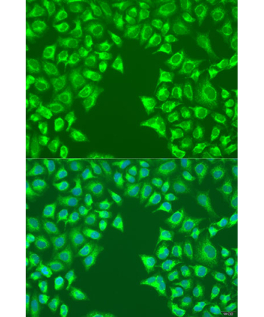 LRP6 Rabbit Polyclonal Antibody