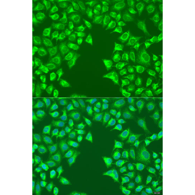 LRP6 Rabbit Polyclonal Antibody