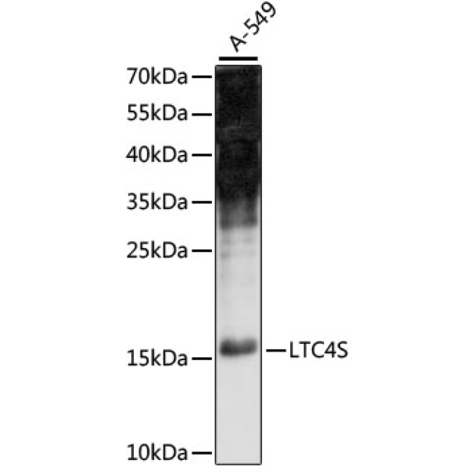 LTC4S Rabbit Polyclonal Antibody