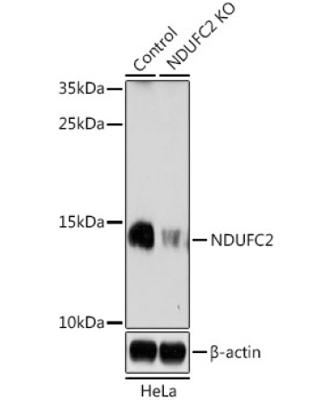 NDUFC2 Rabbit Polyclonal Antibody [KO Validated]