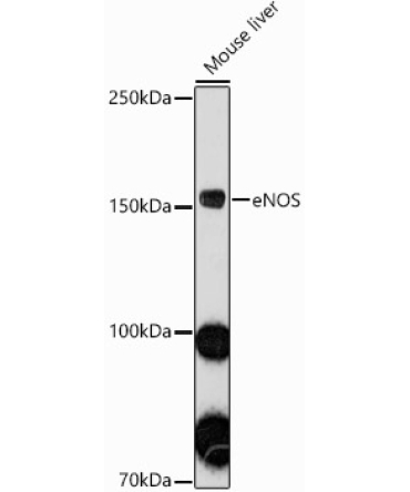 eNOS Rabbit Polyclonal Antibody