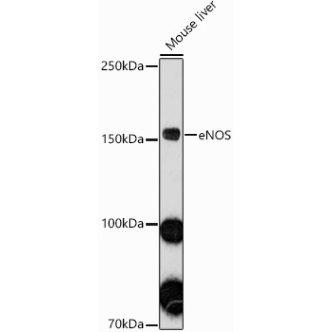 eNOS Rabbit Polyclonal Antibody