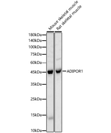 ADIPOR1 Rabbit Polyclonal Antibody