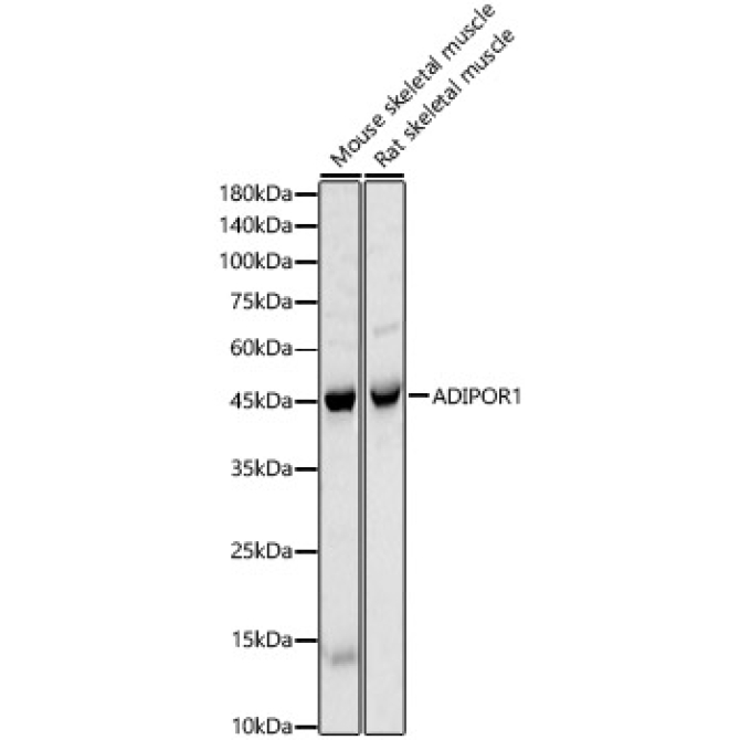 ADIPOR1 Rabbit Polyclonal Antibody