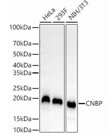 CNBP Rabbit Polyclonal Antibody