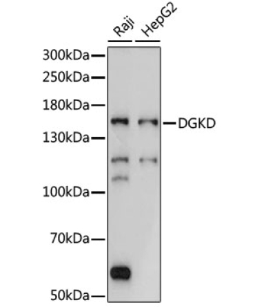 DGKD Rabbit Polyclonal Antibody
