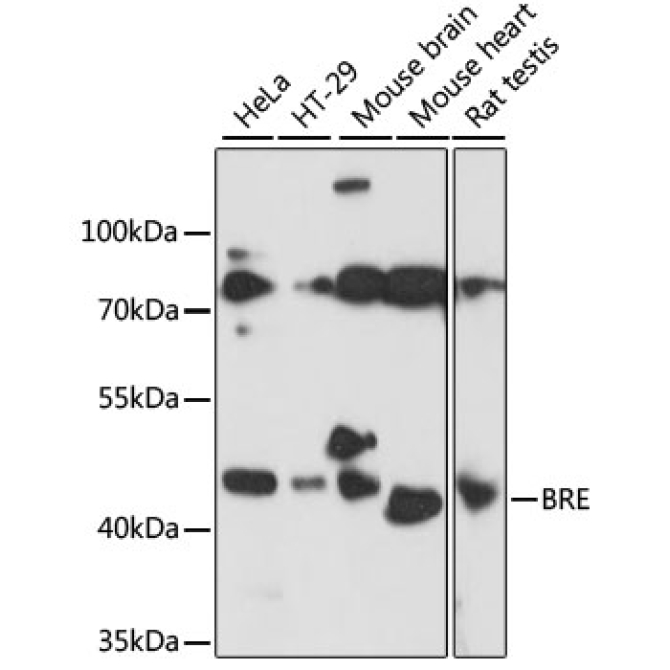 BRE Rabbit Polyclonal Antibody