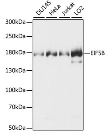 EIF5B Rabbit Polyclonal Antibody