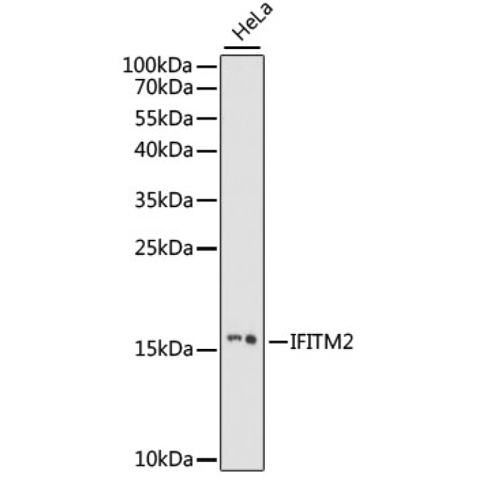 IFITM2 Rabbit Polyclonal Antibody